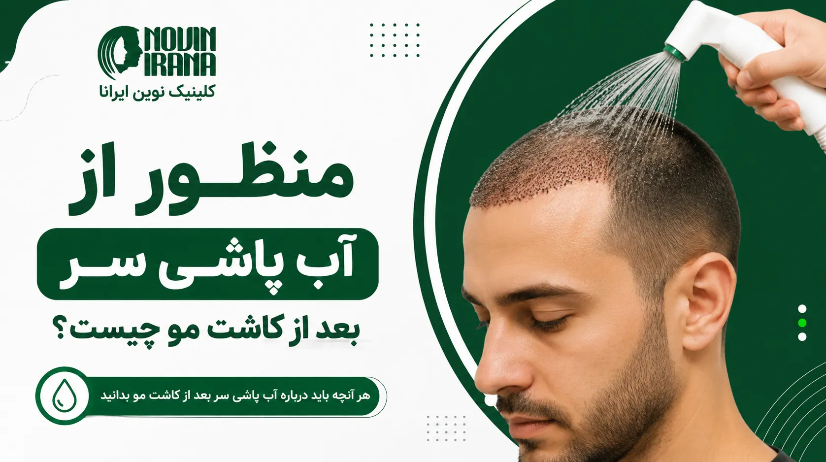 منظور از آب پاشی سر چیست؟